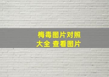 梅毒图片对照大全 查看图片